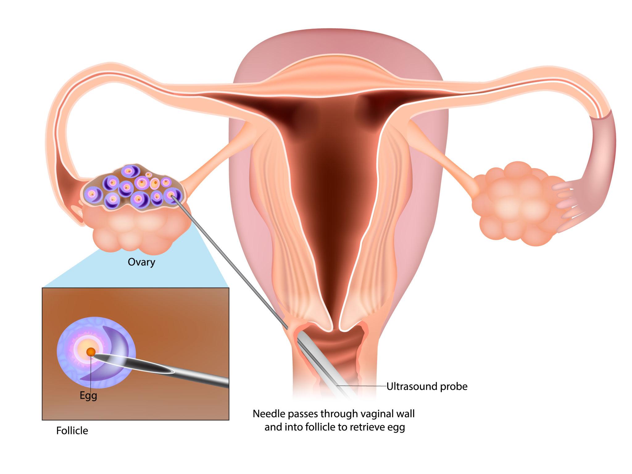 Surrogacy article image: AI Embryo Selection in IVF: Breakthrough or Marketing Trend? 2
