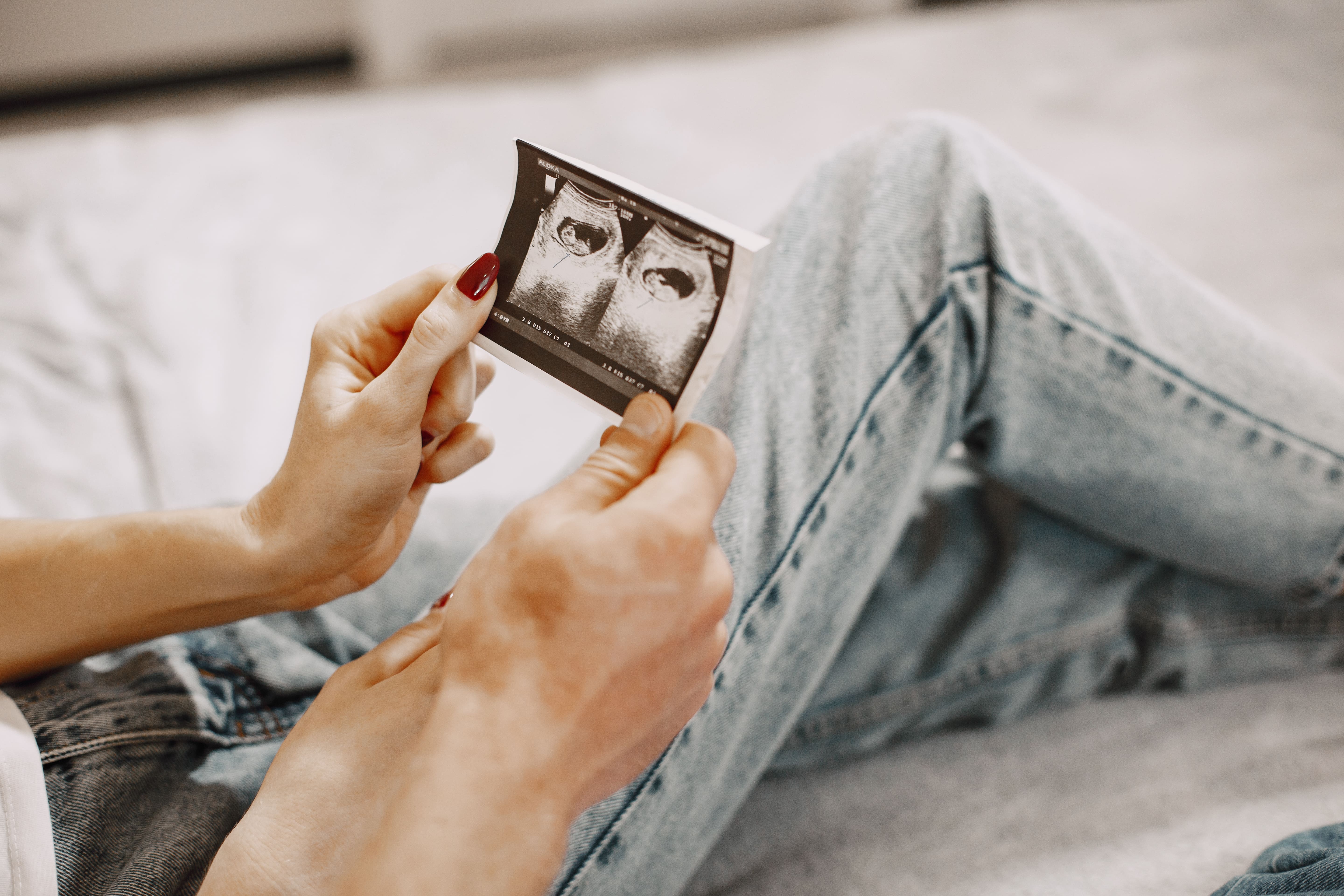 Surrogacy article image: Already Have Embryos? What to Prepare Before Matching With a Surrogate